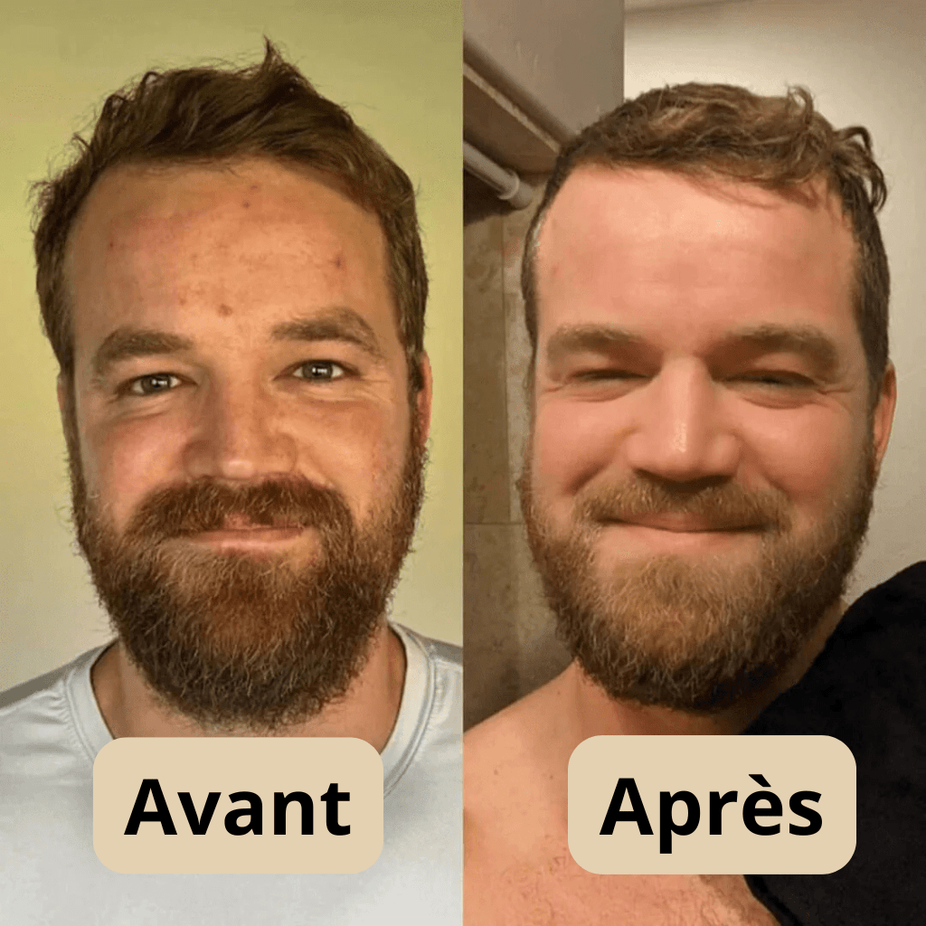 Peel Shot Coréen - Lumeva